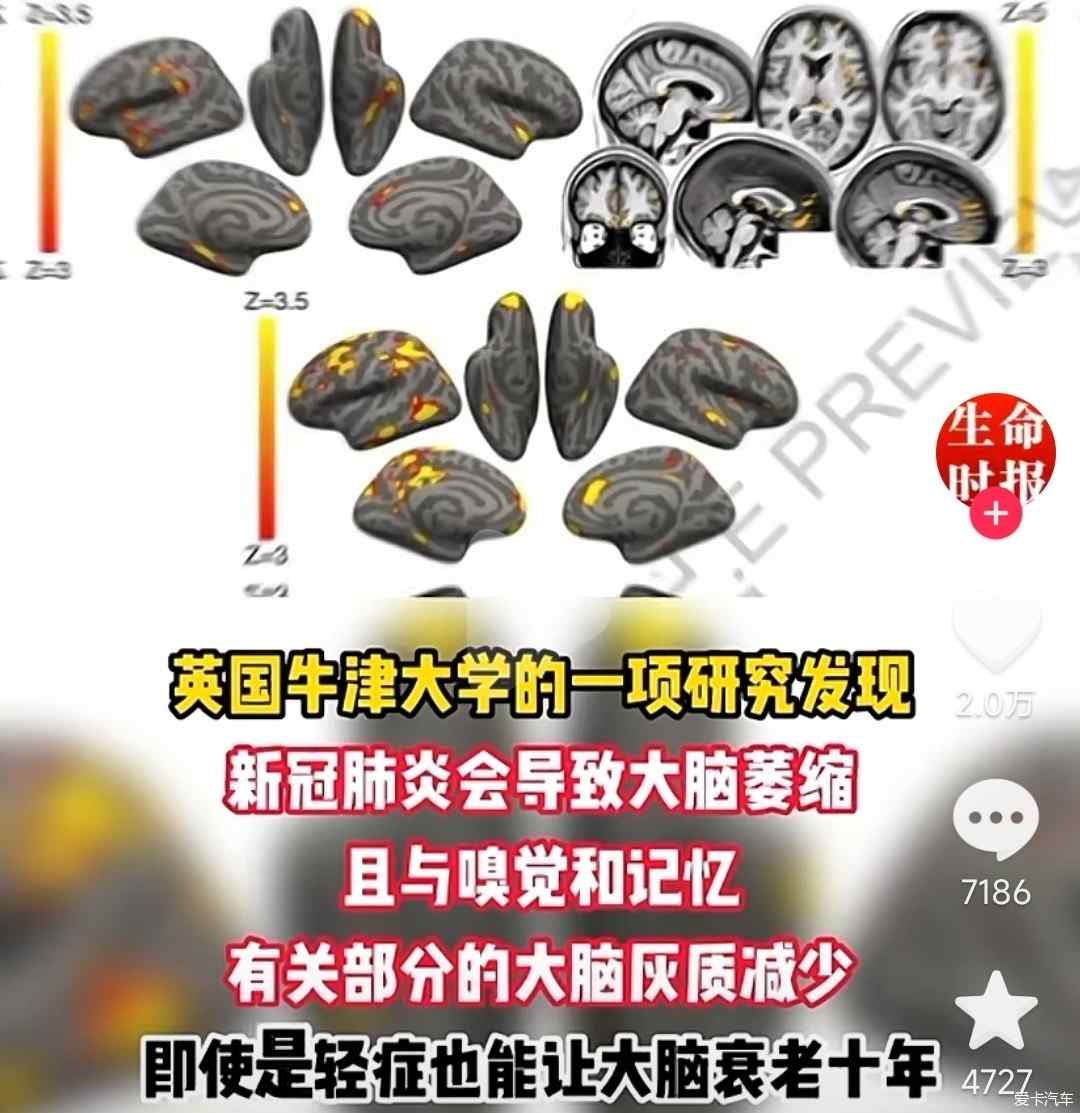 最新研究大脑，友情与探索的温馨篇章